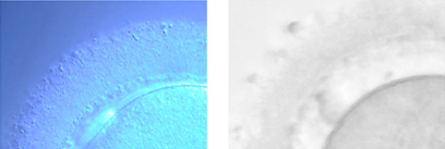 Fresh eggs vs vitrification